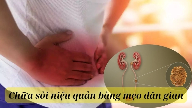 Chữa sỏi niệu quản bằng mẹo dân gian hiệu quả