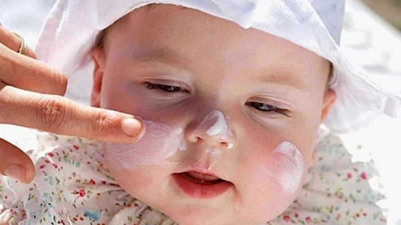 Chàm sữa ở trẻ sơ sinh là gì?