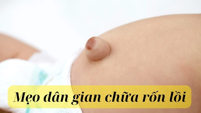 Mẹo dân gian chữa rốn lồi được nhiều mẹ tin dùng