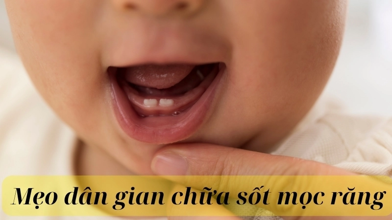 Mẹo dân gian chữa sốt mọc răng đơn giản