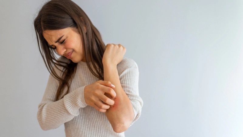 Viêm da cơ địa là một tình trạng da liễu phổ biến