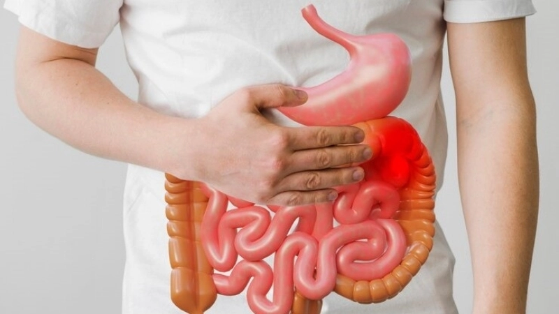 Những nguyên nhân gây ra viêm đại tràng