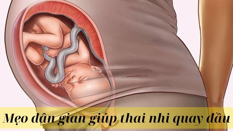 Mẹo dân gian giúp thai nhi quay đầu hiệu quả