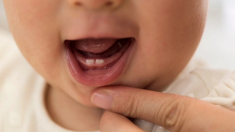 Những mẹo giúp trẻ mọc răng nhanh được nhiều bậc cha mẹ áp dụng
