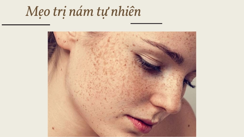 Công thức trị nám tàn nhang từ thiên nhiên