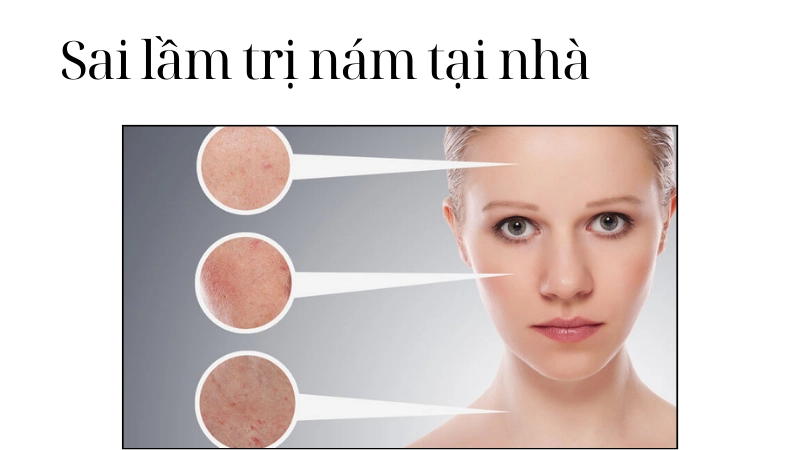 Sai lầm khi trị nám tàn nhang tại nhà nên tránh